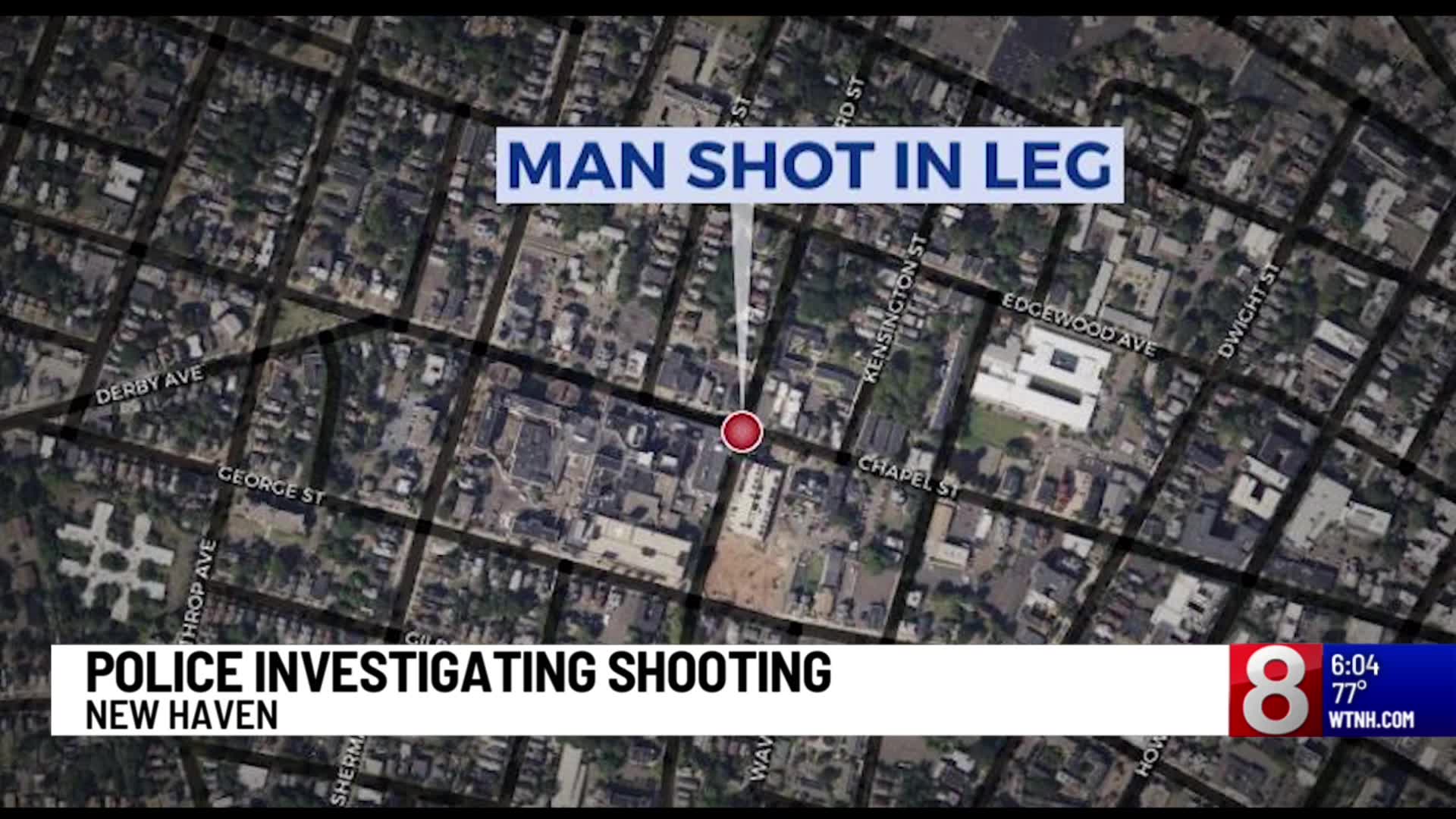 New Haven police investigating after man was shot in the leg – WTNH.com